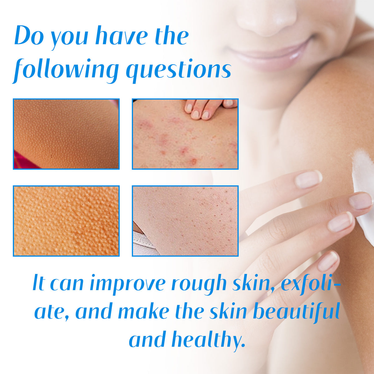 Keratosis Pilaris Repair Cream - Urea Exfoliating Body Lotion