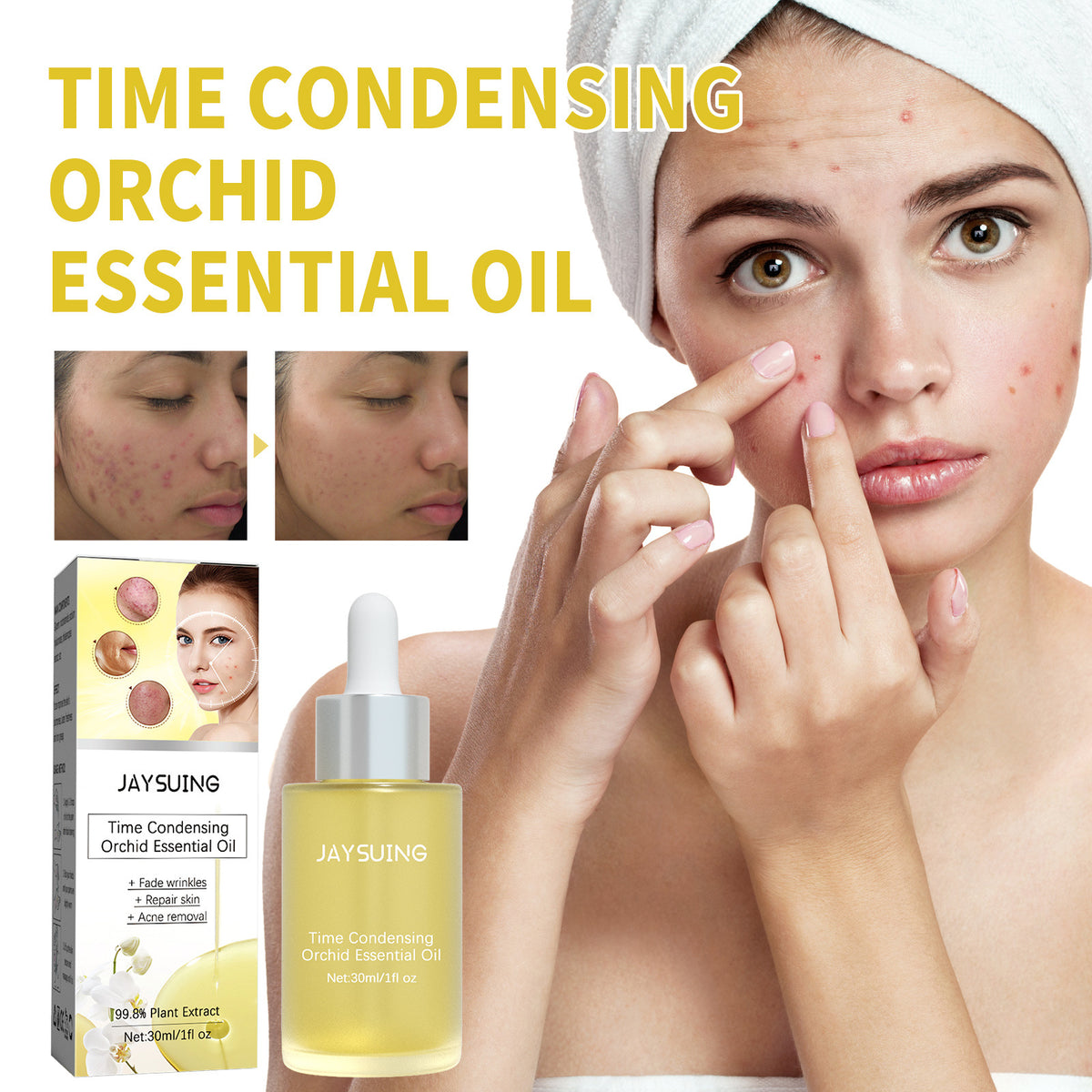 Acne Treatment Oil for Facial Cleansing & Brightening - 30ml
