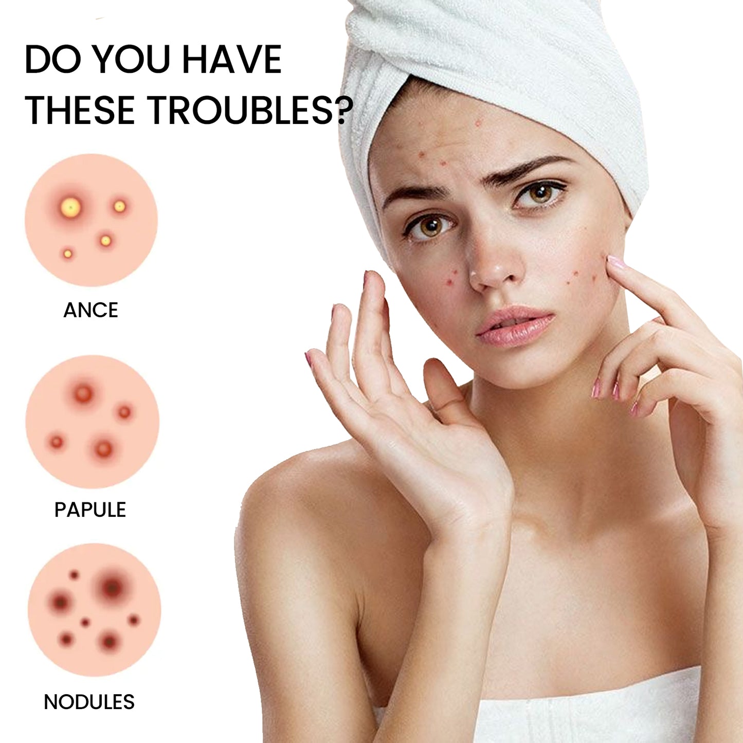 Star Shaped Hydrocolloid Acne Patches - Tea Tree & Witch Hazel Spot Treatment