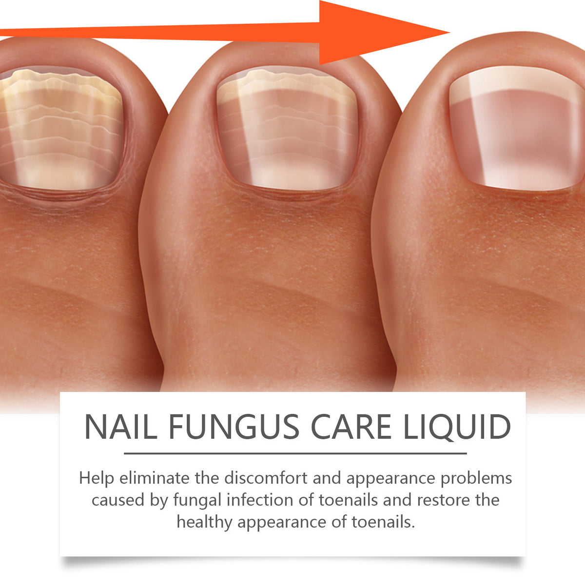 Portable Home Hand And Toe Nail Repair Suit