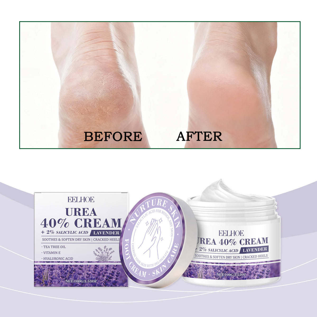 Urea Moisturizing Hand & Foot Cream 100g