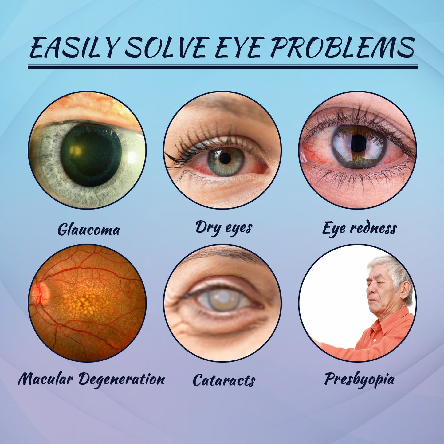 Soothing Eye Drops for Redness, Fatigue, and Dryness Relief - 1 Bottle