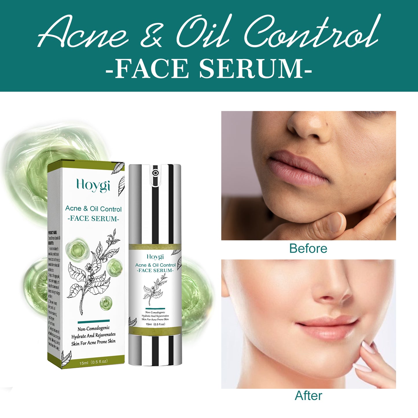 Tea Tree Oil Facial Serum - Pore Tightening & Acne Control Essence