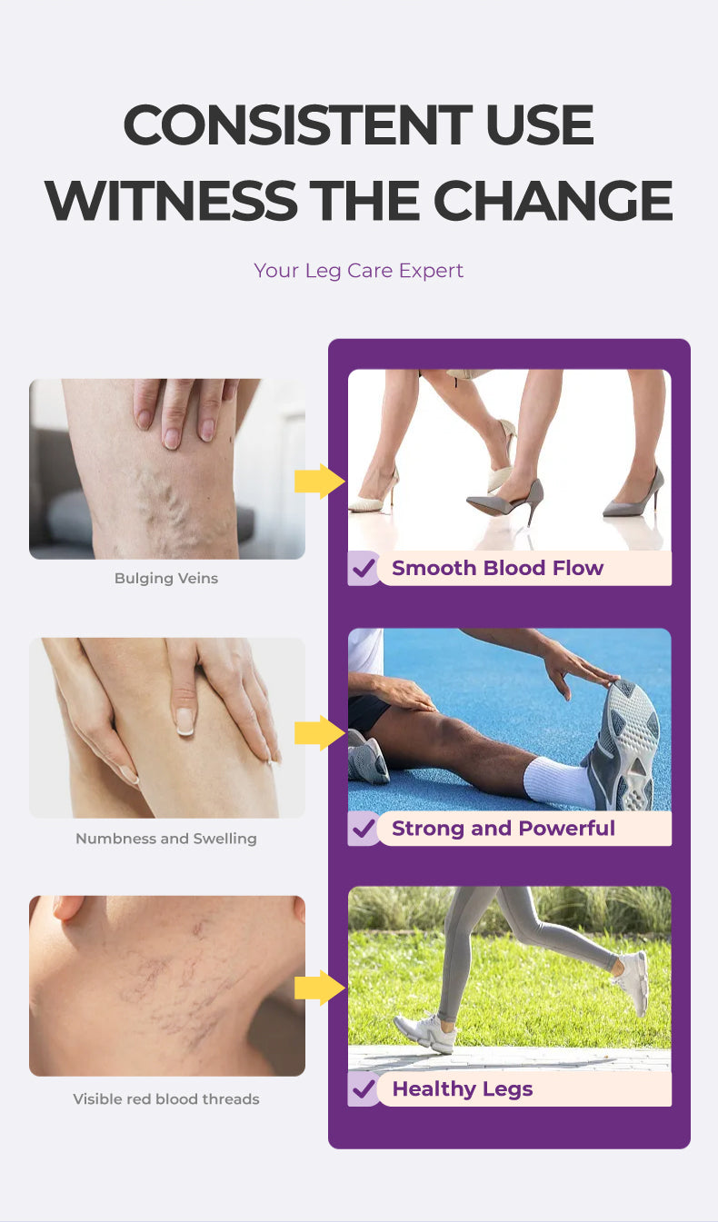 Varicose Vein Relief Cream with Centella Asiatica Root Extract