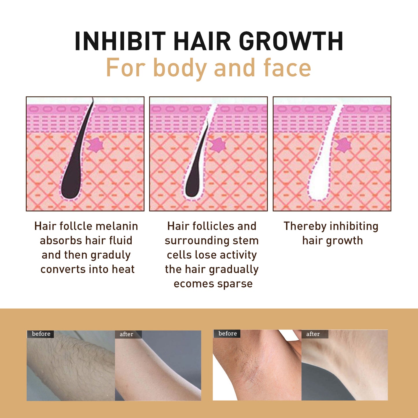 Gentle Hair Removal Spray - Painless Body Hair Remover & Inhibitor 100ml