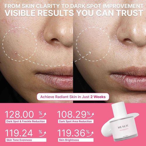 Healic Toning Active Ampoule–Brightening, Hydrating&Soothing with Tranexamic Acid, Niacinamide&Hyaluronic Acid, Dark Spot Correction, Gentle for Sensitive Skin, Korean Skin Care, 50ml/1.69 fl.oz
