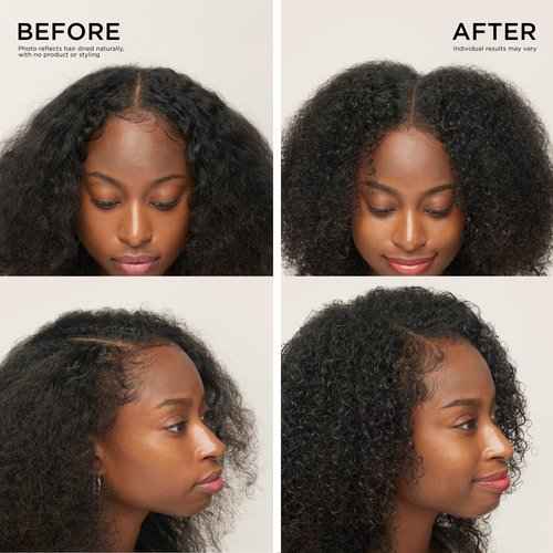 Dr. Groot Thickening Shampoo & Scalp Treatment Set for Hair Loss – Clinical Results with Biotin and Rosemary for Hair Thinning, Shedding, Scalp Repair and Treatment