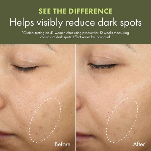 Origins Mega-Mushroom Dark Spot Serum | Reduces Visible Hyperpigmentation & Post-Acne Marks | With Vitamin C & Reishi Mushroom, 1 Fl Oz