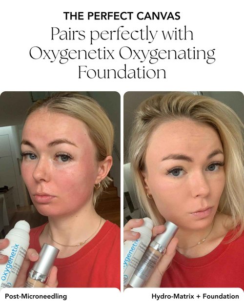 Oxygenetix Oxygenating Hydro-Matrix (2.54oz) | Lightweight Aloe-Based Face Moisturizer with Hyaluronic Acid for Sensitive, Dry, or Compromised Skin