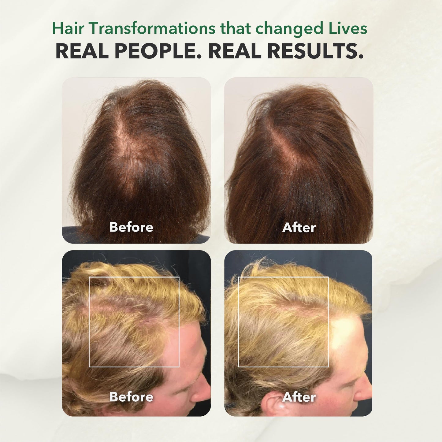 HairSmart Hair Growth Shampoo and Conditioner | Paraben & Sulfate Free with Ayurvedic Herbs | Hair Loss Treatments for Women and Men | Volumizing Shampoo and Conditioner, Pack of 2, 100ml Each