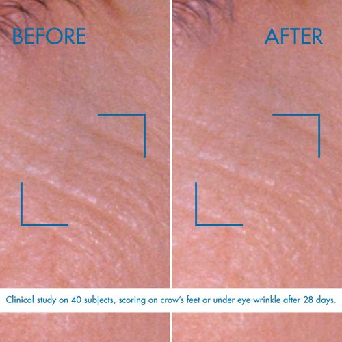 Biotherm Blue Pro-Retinol Wrinkle Smoothing Eye Cream, Anti-Wrinkle and Dark Circles Eye Care with Biotech Plankton & Pro-Retinol, Smoothes and Brightens, Ophthalmologically Tested, Vegan, 0.5 Fl. Oz