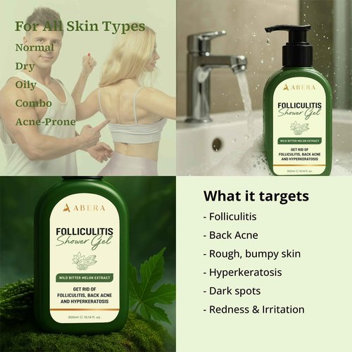 ABERA Folliculitis, BHA Shower Gel, High-Performance Folliculitis Body Wash, Wild Bitter Melon Extract, Reduces Back Acne & Hyperkeratosis, 2 Boxes + Gift Titanium Armpit Serum Roller