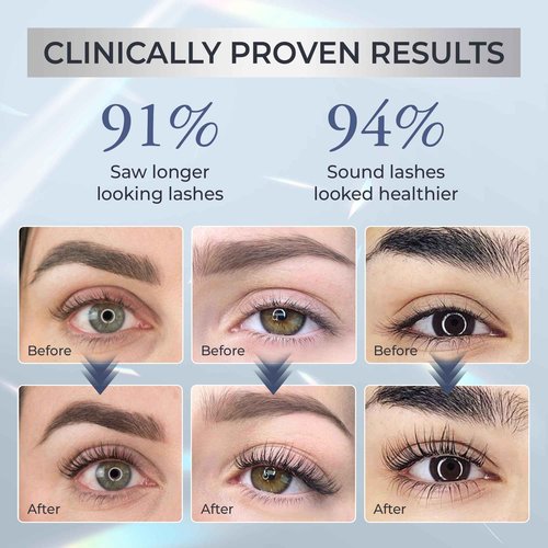 Abera Misan Eyelash Growth Serum (Upgrade Version) - Natural Lash Booster and Lash Enhancer, Regenerating and Nourishing Lashes Longer and Thicker (C. Set of 3)