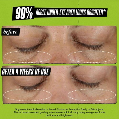 Kiehl's Avocado Eye Treatment, Under Eye Cream for Puffiness and Dark Circles, with Caffeine to Correct Bags, 99% Naturally Derived Non-Toxic Formula