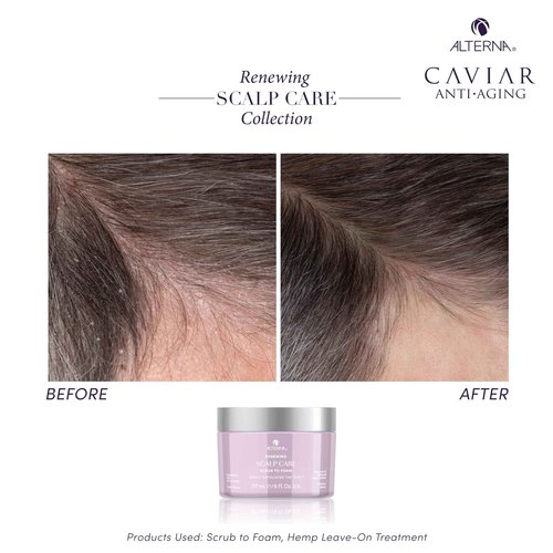 Alterna Haircare Renewing Scalp Care Scrub-to-Foam Vegan Scalp Scrub, 6 Fl Oz Nourishing and Exfoliating Scalp and Hair Treatment