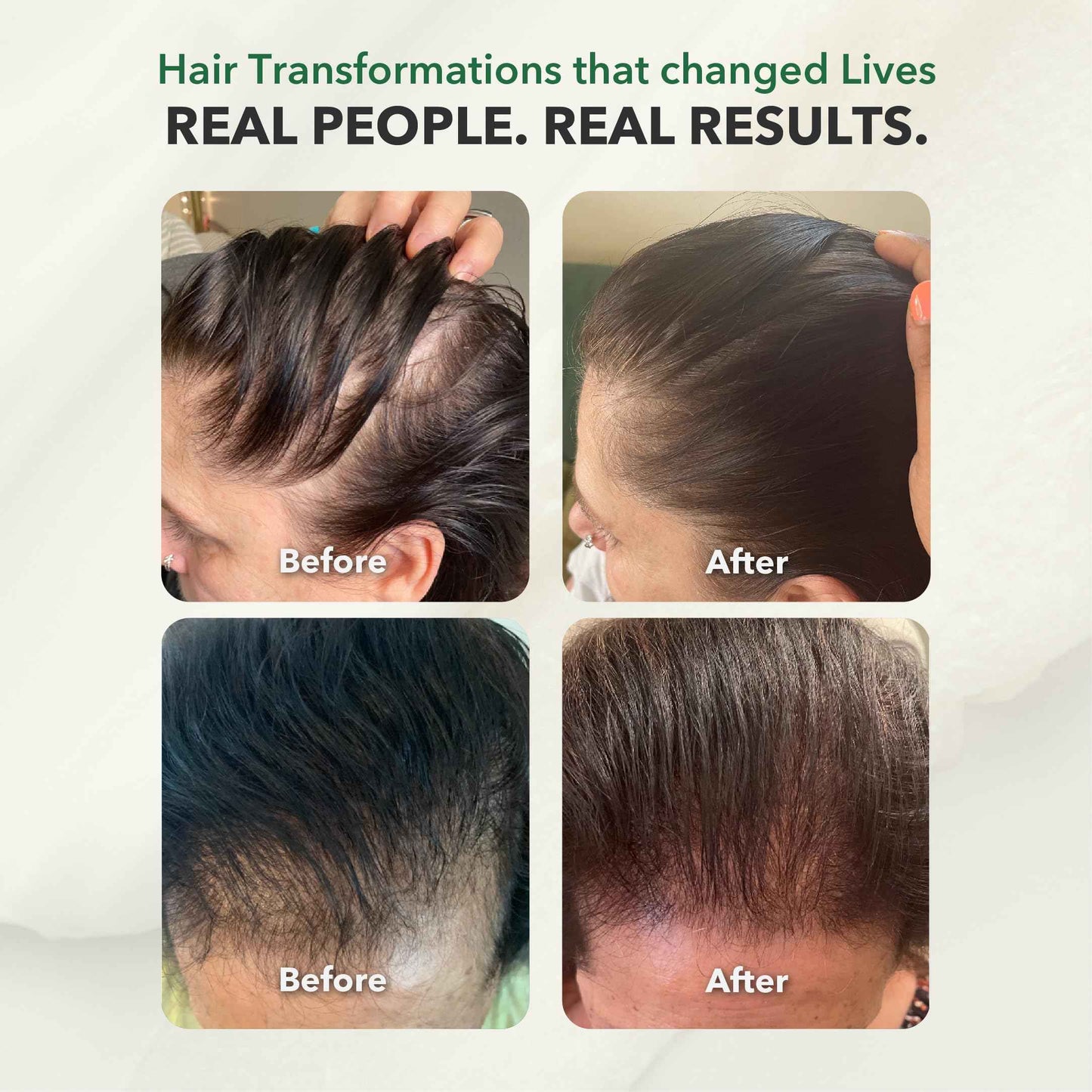 HairSmart Ayurvedic Growth Accelerator Hair Serum for Hair Growth | Serum for Hair Growth | Scalp Serum for Hair | Hair Growth Products, 100ml