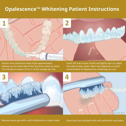 Opalescence 45% Syringes Teeth Whitening Gel - with PF - (8 Syringes) Refill Kit Carbamide Peroxide. Made by Ultradent, in Mint Flavor. Tooth Whitening 5359-4