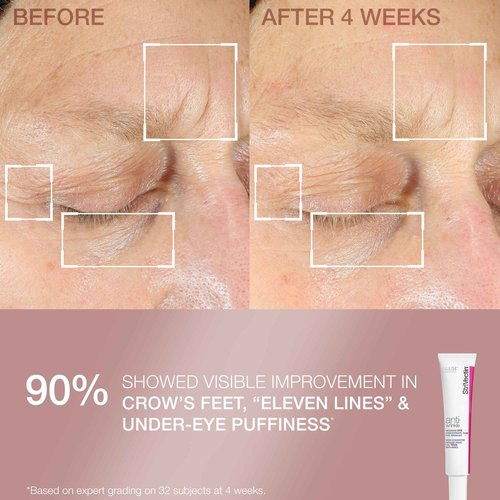 StriVectin Smooth & Hydrate Face Moisturizer and Eye Cream Skin Care 2-Piece Set