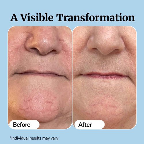 Vibriance Super C Serum for Mature Skin - All-in-One Vitamin Formula Hydrates, Firms, Lifts, Smooths, Targets Age Spots, Wrinkles, 1 fl oz - Pack of 2