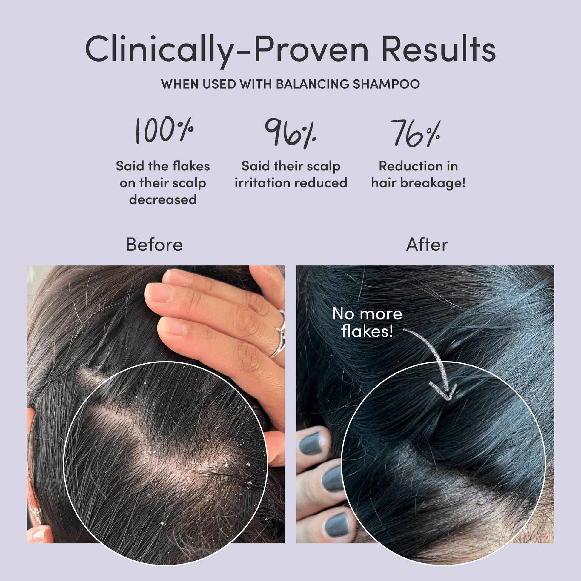 Jupiter Balancing Shampoo and Restoring Serum - Anti Dandruff Shampoo & Serum for Flaky, Itchy, Oily, & Dry Scalp - Nourishes Scalp, Reduces Breakage & Flakes - Color-Safe, Sulfate-Free, Paraben-Free