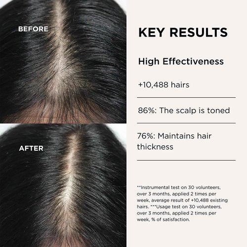 Lazartigue Fuller Hair Serum, Vegan Densifying Growth Treatment with Capixyl & Redensyl, Boosts Volume & Thickness for Fine or Thinning Hair, Silicone & Paraben-Free,1.7 Fl Oz