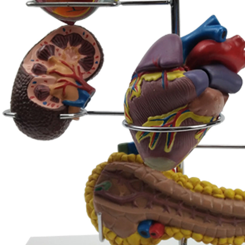 Diabetes Pathology Teaching Model - Medical Education Demonstration Tool
