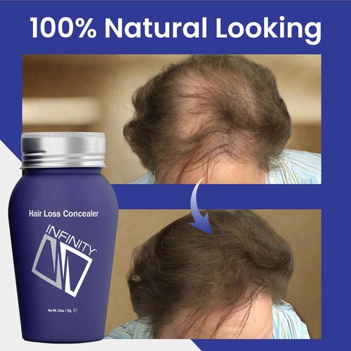 INFINITY Hair Fibers Dark Brown for Thinning Hair for Women & Men - 100% Undetectable Hair Building Fiber Powder - Conceal Hair Loss in 15 Seconds, 60g