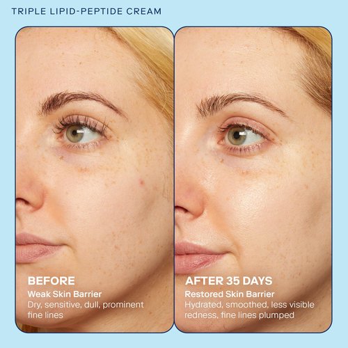 Skinfix Barrier+ Triple Lipid-Peptide Cream (1.7 oz) + Barrier+ Triple Lipid-Boost 360 Eye (0.5 oz) - Non-Comedogenic - Fragrance Free - Vegan, Cruelty Free