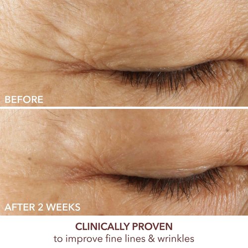 Dr. Dennis Gross Advanced Retinol + Ferulic Eye Serum – Target Dark Circles, Puffiness, Fine Lines & Wrinkles for Smooth, Youthful-Looking Eyes, 0.5 oz