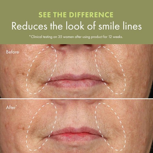 Origins Plantscription Anti-Aging Serum with Retinoid | Visibly Reduces Stubborn Wrinkles | With Retinoid & Peptide | Gentle Enough for First Time Retinoid Users | Travel Size, 1 Fl Oz