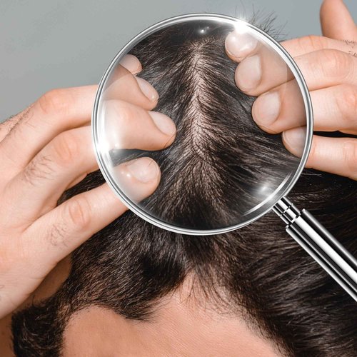 ABERA High-Performance Anti-Dandruff Shampoo with Langbian Ginseng Extract, Sulfate Free Paraben Free, 5,07 Fl Oz |2 Box + Free 1 Hair Growth Serum|