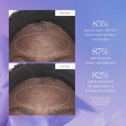 KORA Organics Plant Stem Cell Retinol Alternative Moisturizer, Active Retinol Alternative Smooths Wrinkles & Firms Skin, Face Moisturizer for Women & Men, Certified Organic, Cruelty Free, 1.69 fl oz