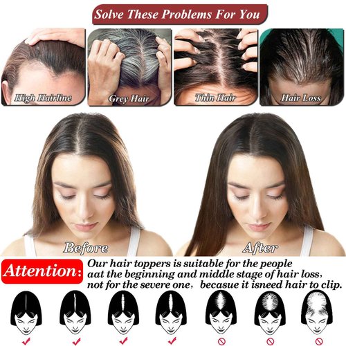 JGS1996 Hair Toppers for Women Real Human Hair 150% Density Hand Made Lace Base Remy Hair Wig Topper with Thinning Hair Pieces No Bangs Clip in Hair Extensions