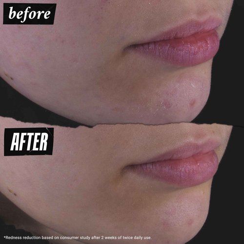 Kiehl's Calendula Herbal Extract Alcohol-free Toner, Soothing Facial Toner for Normal to Oily Skin, Visibly Reduces Redness & Oil, Improves Skin Texture, Paraben-free, Fragrance-free - 16.9 fl oz