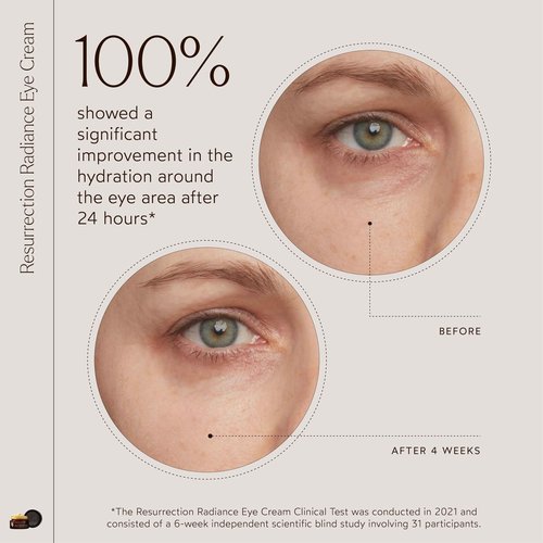 True Botanicals Resurrection Radiance Brightening Eye Cream | Reduces Appearance of Dark Circles, Fine Lines, Wrinkles & Puffiness | Dermatologist Tested, All Natural, Vegan| 0.5 oz | 15 ml