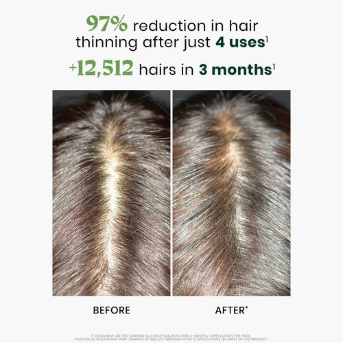 Rene Furterer Triphasic Reactional Concentrated Serum - Thinning Hair caused by stress, postpartum, seasonal change - Drug-Free - Breastfeeding Safe - Dermatologist tested - 12 ct., 3-Month Supply