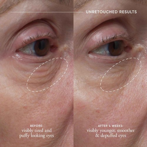 philosophy 2-pc duo for bright eyes & bouncy skin skincare gift set