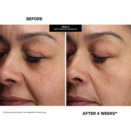 Kate Somerville Mega-A Skin Transforming Serum – Anti-Aging Serum with Hyaluronic Acid For Uneven Texture and Wrinkles, 1 Fl. Oz