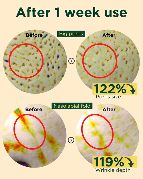 EASYDEW DW-EGF Peptide Retinol 0.03% Cream – Beginner Retinol Night Cream for Hypoallergenic Skin Care - Firm Skin, Wrinkle Improvement - Korean Daily Anti Aging Face & Neck Treatment, 1.01fl. oz.