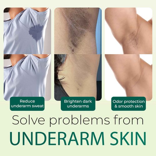 ABERA Folliculitis, BHA Shower Gel, High-Performance Folliculitis Body Wash, Wild Bitter Melon Extract, Reduces Back Acne & Hyperkeratosis, 2 Boxes + Gift Titanium Armpit Serum Roller