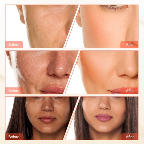 Diamond Microdermabrasion Dermabrasion Machine 3 in 1 Skin Rejuvenation Beauty Machine Blackheads Remove Elitzia ETNF108