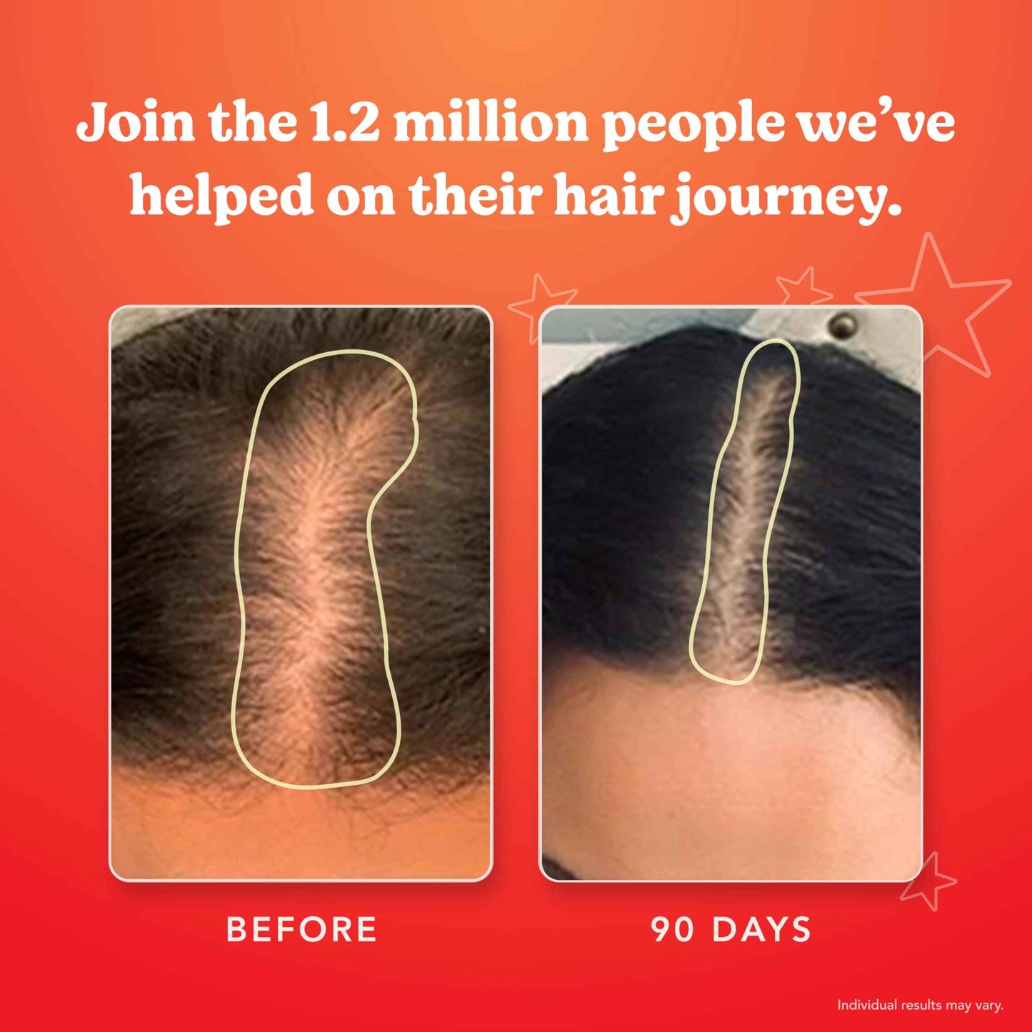 HAIRtamin Vegan Gummy Stars Hair Vitamins | Non-GMO | Natural Biotin Hair Vitamin Gummies to Maintain Healthy Hair Skin & Nails | Multivitamin Supplement to Help Maintain Healthy Looking Hair (3-Pack)