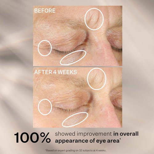 StriVectin Anti-Wrinkle Intensive Eye Cream Concentrate for Wrinkles PLUS, Targets Crow's Feet, Firmness, Puffiness and Dark Circles, 1 Fl oz