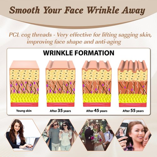 PCL Cog Threads 4D COG PDO Thread for Face Lifting 360R Bidirectional Barb (Blunt-Type) PCL Threads for Face/Whole Body Lift 19G100mm 10pcs