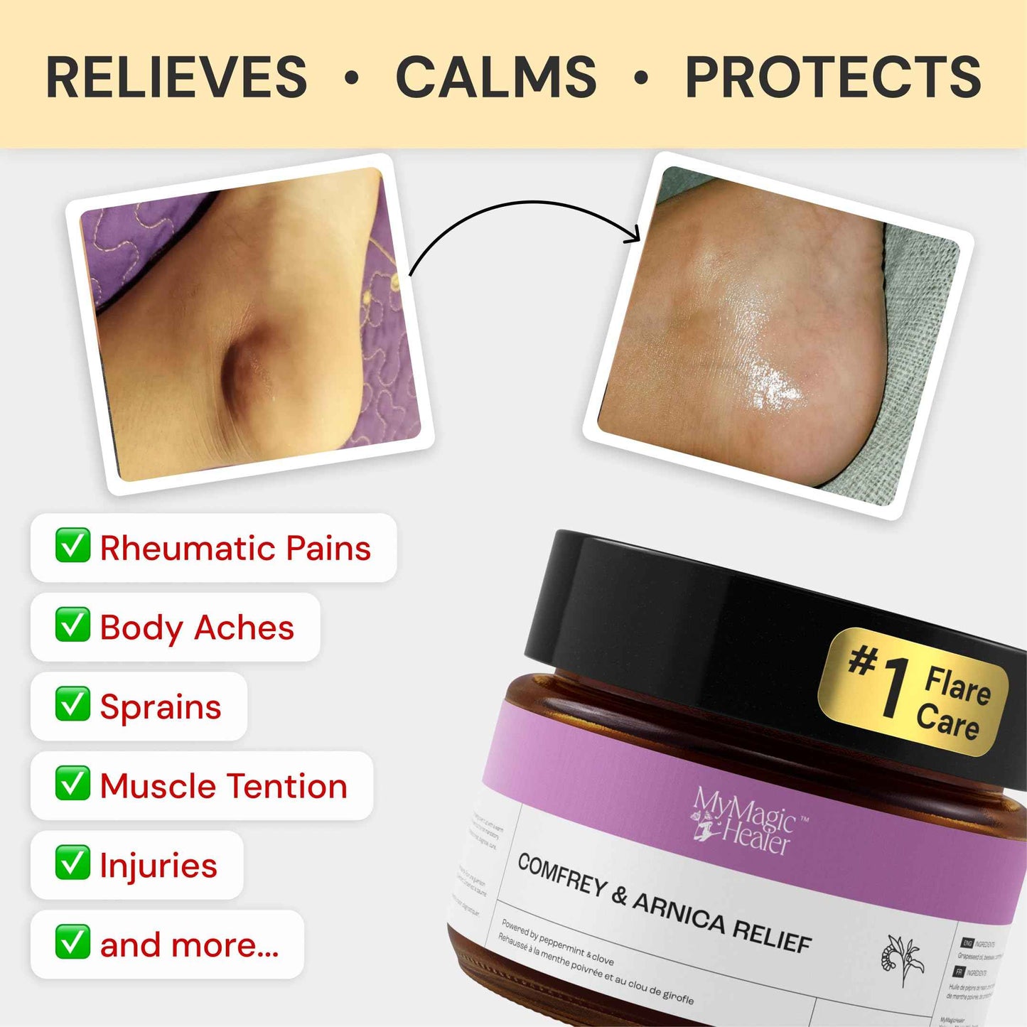 MyMagicHealer Comfort Flare Care | 1oz Collection of All-Natural Salves for Skin Flare-Ups Convenient Relief for Skin Flare-Ups, Acne, Boils, Muscle & Joint Discomfort – Perfect for Travel