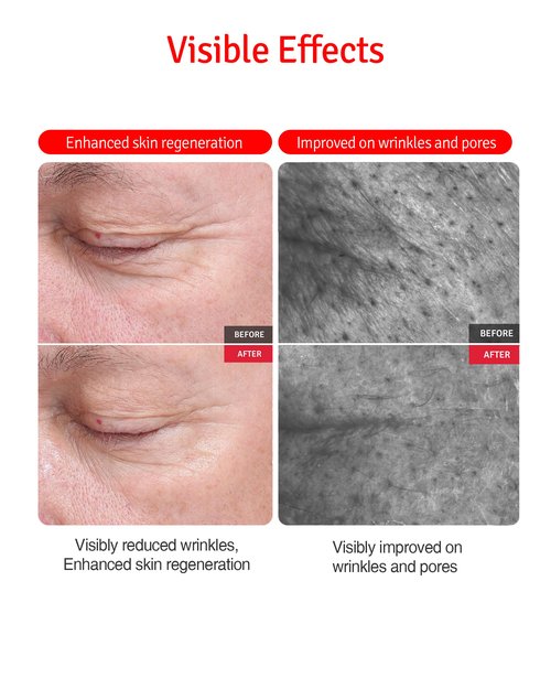 VITABRID C12 Wrinkle Cream - Age Defying Skin Recovery Moisturizer with Peptides, Vitamin C, Shea Butter - Wrinkle Repair Moisturizing Day & Night Skincare for Face and Neck - Fragrance Free, 1.69oz.