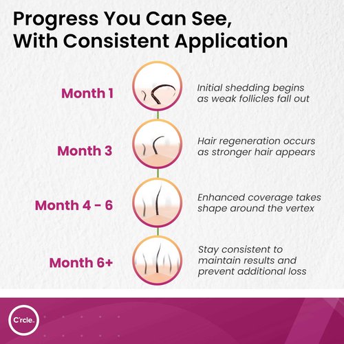 C'rcle Minoxidil for Women 5% Foam - Helps Restore Top of Scalp Hair Loss and Support Hair Growth for Women, Regrowth with Unscented Topical Treatment for Thinning Hair (5% Foam 8-Month Supply)