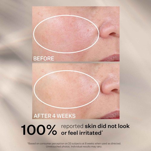 StriVectin Advanced Retinol Intensive Night Moisturizer, 1 Fl Oz