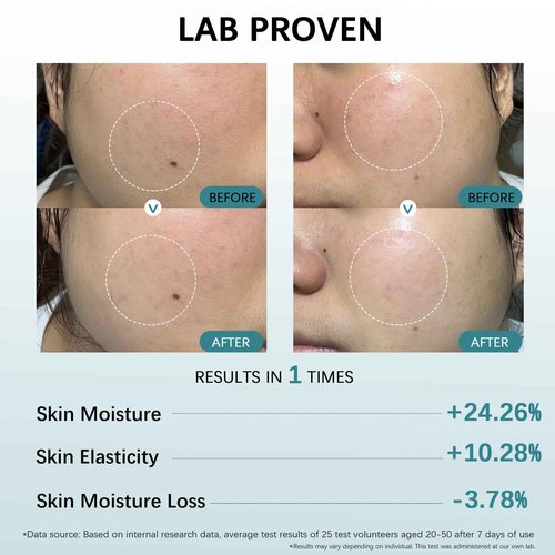 Post Microneedling Serum, After Microneedling Care, Tremella Extract+Freeze-Dried Hydrolyzed Collagen Serum, All Preservatives-Free, Instant Deep Hydration Smoothing, Soothing for Sensitive Skin(25ml)