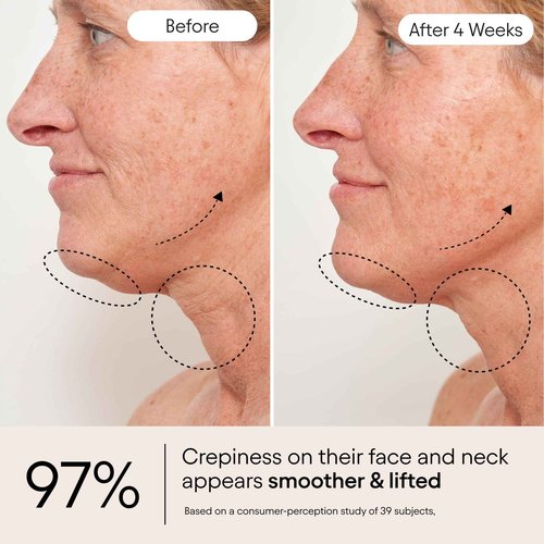 ALPYN Super Sculpt Serum, Face & Neck with Tri-Peptide Firming Complex, 1.7 oz